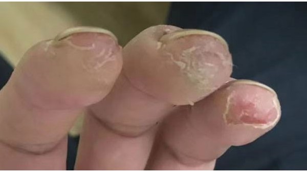 ���̽�˵-Ϊʲô���������ͻ���ֹ���������